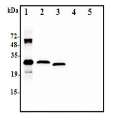 Western blot analysis using anti-IL-37 (human), pAb (Prod. No. AG-25A-0111) at 1:2.000 dilution:1. Recombinant human IL-37-His (50ng)2. Human IL-37-FLAG transfected HEK293 cell lysate(100µg)3. Human IL-37-tag free transfecte