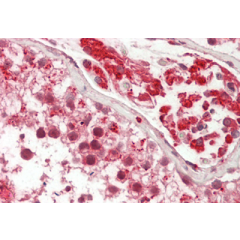 Immunohistochemical staining of CTRP1 using anti-CTRP1 (human), pAb (Prod. No. AG-25A-0114) in human testis tissue (15µg/ml). This antibody has been tested in immunohistochemistry, analyzed by an anatomic pathologist and validated for use in I