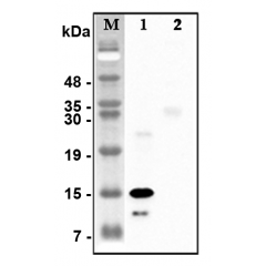 Western blot analysis of recombinant human CTRPs using anti-CTRP5 (human), pAb (Prod. No. AG-25A-0116) at 1:4,000 dilution.1: Recombinant human CTRP5 protein (His-tagged).2: Unrelated recombinant protein (His-tagged).