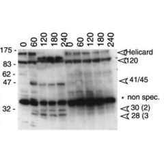 Western blot analysis anti-MDA5 (mouse), pAb (AL180) (Prod. No. AG-25B-0001) detecting the cleavage of endogenous mouse MDA5 as an indicator of apoptosis. Method: Cleavage of endogenous Helicard in murine A20 B lymphomas undergoing Fas-mediated apo