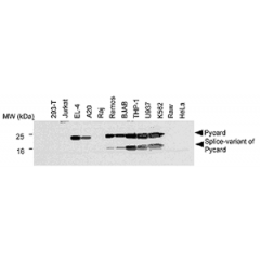 Western blot analysis of human and mouse cell lines using anti-Asc, pAb (AL177) (Prod. No. AG-25B-0006). 
Total protein extracts from various human (293-T, Jurkat, Raj, Ramos, BJAB, THP-1, U937, K562, Raw, HeLa) and mouse (EL-4, A20) cell lines were