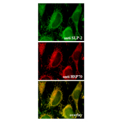 Endogenous SLP-2 is localized to the mitochondria (Immunocytochemical staining).  Endogenous SLP-2 (green) (up) and endogenous mitochondrial HSP70 (red) (middle) were detected in methanol fixed HeLa cells using anti-SLP-2, pAb (Prod. No. AG-20B-0019