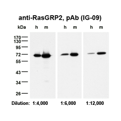 Western Blot on human (h) and mouse (m) platelets samples (5μg protein each per lane) using anti-RasGRP2, pAb (IG-09) (AG-25T-0118), diluted as indicated in TBS/Tween (0.1%) with 5% milk.