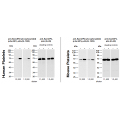 Western blot: Human (5μg protein/lane) and mouse (8μg protein/lane) platelets were either not stimulated (-) or were incubated with 5μM Forskolin for 1 min (+). Western blots at the indicated dilutions were performed using anti-RasGRP2 (phosphorylated) (p
