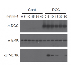 Netrin-1 (human):Fc (human) (rec.) (Prod. No. AG-40B-0075) triggers a DCC-dependent phosphorylation of ERK1/2. Method: HEK 293 cells (Control) or HEK 293 expressing the netrin-1 receptor DCC were incubated with netrin-1 (human):Fc (