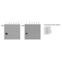 Western blot with extracellular domains (ecd) of different related human receptors (50ng per lane) reveals that anti-Activin Receptor IIB, pAb (IG-510) (Prod. No. AG-25T-0114) (dilution 1:5000) specifically recoginzes ACTR-IIB under nonreducing (-ßME, lef