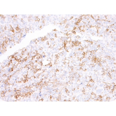 PD-1 receptor-induced CD4 T cell activation and proliferation by PD-1 (mouse), mAb (blocking) (1H10) (AG-20B-0075).Method: Magnetic bead affinity purified CD4+ T cells from C57BL/6 mice are stimulated in vitro with PD-1 (mouse), mAb (b