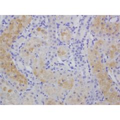 Immunohistochemical staining of cisplatin-treated rat kidney using anti-HEL, mAb (5F12).