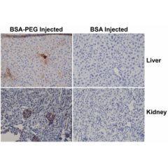 Immunohistochemical staining of formalin fixed and paraffin embedded LNCaP cells overexpressing HA-tag Bag1 protein, using anti-HA-tag rabbit monoclonal antibody (clone RM305) at 0.01 ug/mL.