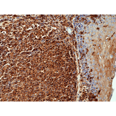 Immunohistochemical staining of formalin fixed and paraffin embedded human tonsil tissue using Anti-beta actin Rabbit Monoclonal Antibody (Clone RM112) at a 1:1000 dilution.