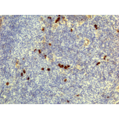 Immunohistochemistry of Human Lymphoid Tissue using Anti-Human IgD antibody RM123.
