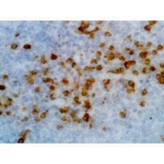 Immunohistochemical staining of formalin fixed and paraffin embedded human tonsil tissue section using anti-human Ig kappa light chain rabbit monoclonal antibody (Clone RM126).