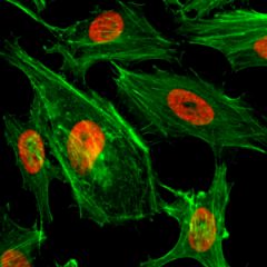 Immunocytochemistry of HeLa cells treated with sodium butyrate, using Dimethyl-Histone H3 (Lys4) Rabbit mAb RM135 (red). Actin filaments have been labeled with fluorescein phalloidin (green).