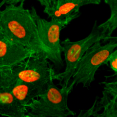 Immunocytochemistry of HeLa cells treated with sodium butyrate, using Acetyl-Histone H3 (Lys36) Rabbit mAb RM154 (red). Actin filaments have been labeled with fluorescein phalloidin (green).