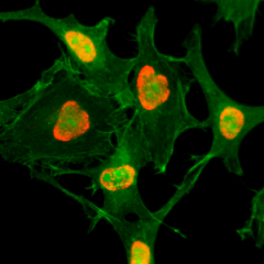 Immunocytochemistry of HeLa cells treated with sodium butyrate, using Acetyl-Histone H3 (Lys79) Rabbit mAb RM156 (red). Actin filaments have been labeled with fluorescein phalloidin (green).