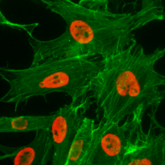 Immunocytochemistry of HeLa cells treated with sodium butyrate, using Acetyl-Histone H3 (Lys27) Rabbit mAb RM172 (red). Actin filaments have been labeled with fluorescein phalloidin (green).