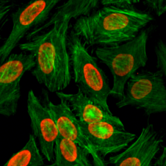 Immunocytochemistry of HeLa cells treated with sodium butyrate, using Dimethyl-Histone H3 (Lys9) Rabbit mAb RM151 (red). Actin filaments have been labeled with fluorescein phalloidin (green).