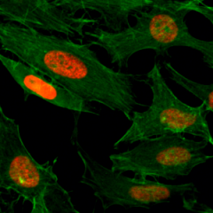Immunocytochemistry of HeLa cells treated with sodium butyrate, using Acetyl-Histone H3 (Lys4) Rabbit mAb RM149 (red). Actin filaments have been labeled with fluorescein phalloidin (green).