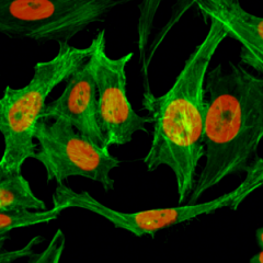 Immunocytochemistry of HeLa cells treated with sodium butyrate, using Monomethyl-Histone H3(Lys9) Rabbit mAb RM150 (red). Actin filaments have been labeled with fluorescein phalloidin (green).