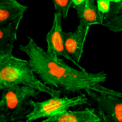 Immunocytochemical staining of HeLa cells treated with sodium butyrate, using anti-Monomethyl-Histone H4 (Arg3) Rabbit Monoclonal Antibody (clone RM195) (red). Actin filaments have been labeled with fluorescein phalloidin (green).