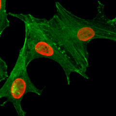Immunocytochemical staining of HeLa cells treated with sodium butyrate, using anti-Acetyl-Histone H4 (Lys5) Rabbit Monoclonal Antibody (clone RM199) (red). Actin filaments have been labeled with fluorescein phalloidin (green).