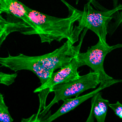 Immunocytochemical staining of HeLa cells treated with sodium butyrate, using anti-Acetyl-Histone H2A.Z (Lys4) Rabbit Monoclonal Antibody (clone RM221) (red). Actin filaments have been labeled with fluorescein phalloidin (green).