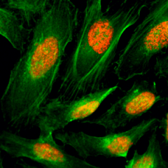 Immunocytochemistry of HeLa cells, using Anti-Histone H4 Rabbit mAb RM212 (red). Actin filaments have been labeled with fluorescein phalloidin (green).