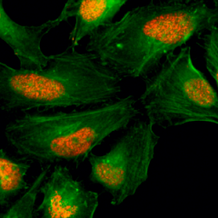 Immunocytochemistry of HeLa cells, using Histone H2AX Rabbit mAb RM214 (red). Actin filaments have been labeled with fluorescein phalloidin (green).