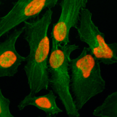 Immunocytochemistry of HeLa cells, using Anti-Histone H2AZ Rabbit mAb RM215 (red). Actin filaments have been labeled with fluorescein phalloidin (green).