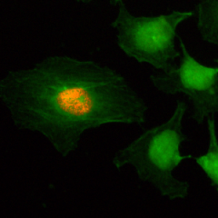Immunocytochemistry of HeLa cells, using Anti-Phospho-Histone H2A/H4 (Ser1) Rabbit mAb RM216 (red). Actin filaments have been labeled with fluorescein phalloidin (green).
