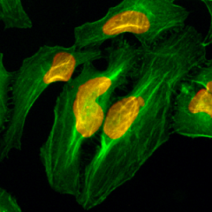 Immunocytochemistry of HeLa cells, using Anti-Histone H2A Rabbit mAb RM225 (red). Actin filaments have been labeled with fluorescein phalloidin (green).