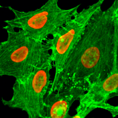 Immunocytochemical staining of HeLa cells treated with sodium butyrate, using anti-Acetyl-Histone H2B (Lys20) Rabbit Monoclonal Antibody (clone RM235) (red). Actin filaments have been labeled with fluorescein phalloidin (green).