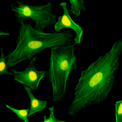 Immunocytochemistry of HeLa cells, using anti-Histone macroH2A1/macroH2A2 Rabbit mAb RM248 (red). Actin filaments have been labeled with fluorescein phalloidin (green).