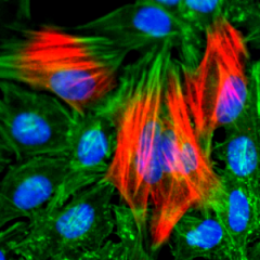 Immunocytochemistry of HeLa cells, using Calponin-1 Rabbit Monoclonal Antibody (Clone RM262) (red). Actin filaments have been labeled with fluorescein phalloidin (green), and nucleus stained with DAPI (blue).