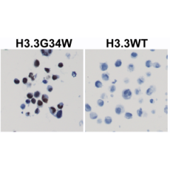 Immunohistochemical staining of formalin fixed and paraffin embedded 293T cells transfected with a DNA construct encoding Histone H3.3 G34W mutant or wild type, stained with anti-Histone H3.3 G34W clone RM263.