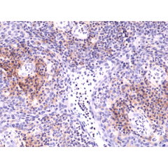 Immunohistochemical staining of formalin fixed and paraffin embedded human Tonsil tissue sections using Anti-Integrin alpha 4 Rabbit Monoclonal Antibody (Clone RM268) at a 1:5000 dilution.