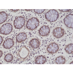 Immunohistochemical staining of formalin fixed and paraffin embedded human colon tissue sections using anti-CD29 rabbit monoclonal antibody (clone RM285) at a 1:200 dilution.