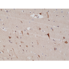 Immunohistochemical staining of formalin fixed and paraffin embedded human brain tissue sections using Anti-PSD95 Rabbit Monoclonal Antibody (Clone RM288) at a 1:200 dilution.