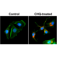 Immunocytochemical staining of HeLa cells untreated or treated with chloroquine (CHQ), using anti-LC3B rabbit monoclonal Antibody Clone RM293 (red) at a 1:200 dilution. Actin filaments have been labeled with fluorescein phalloidin (green), and nucleus lab