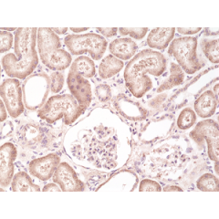 Immunohistochemical staining of formalin fixed and paraffin embedded human kidney tissue section using anti-B-raf rabbit monoclonal antibody (Clone RM308) at a 1:500 dilution.