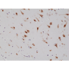 Immunohistochemical staining of formalin fixed and paraffin embedded human brain tissue section using anti-NeuN rabbit monoclonal antibody (Clone RM312) at a 1:1000 dilution.