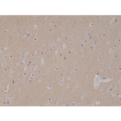 Immunohistochemical staining of formalin fixed and paraffin embedded human brain tissue section using anti-CD56 rabbit monoclonal antibody (Clone RM315) at a 1:1000 dilution.