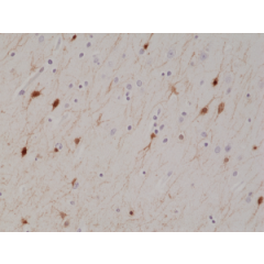 Immunohistochemical staining of formalin fixed and paraffin embedded human brain tissue section using anti-Calretinin rabbit monoclonal antibody (Clone RM324) at a 1:1000 dilution.