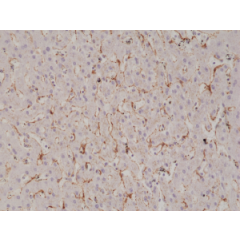 Immunohistochemical staining of formalin fixed and paraffin embedded human liver tissue section using anti-Caveolin-1 rabbit monoclonal antibody (Clone RM325) at a 1:1000 dilution.