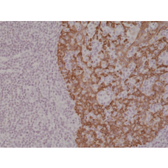 Immunohistochemical staining of formalin fixed and paraffin embedded human tonsil tissue section using anti-CK-14 rabbit monoclonal antibody (Clone RM328) at a 1:2000 dilution.