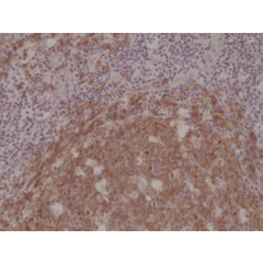 Immunohistochemical staining of formalin fixed and paraffin embedded human Tonsil tissue section using anti-CD19 rabbit monoclonal antibody (Clone RM332) at a 1:1000 dilution.