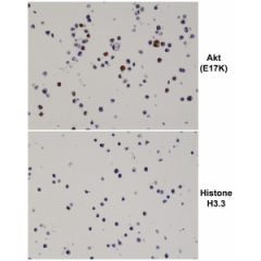 Immunohistochemical staining of formalin fixed and paraffin embedded 293T cells transfected with a DNA construct encoding the Akt E17K mutation or Histone H3.3, stained with anti-Akt E17K rabbit monoclonal antibody (clone RM336) at 0.2ug/mL.