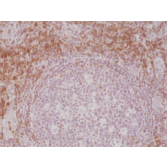 Immunohistochemical staining of formalin fixed and paraffin embedded human Tonsil tissue section using anti-CD3e rabbit monoclonal antibody (Clone RM344) at a 1:200 dilution.