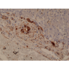 Immunohistochemical staining of formalin fixed and paraffin embedded human Liver tissue section using anti-GSTP1 rabbit monoclonal antibody (Clone RM347) at a 1:20000 dilution.
