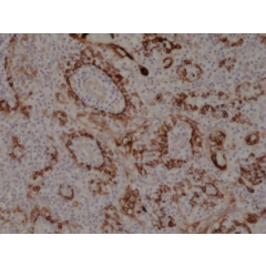 Immunohistochemical staining of formalin fixed and paraffin embedded human tonsil tissue section using anti-CK-17 rabbit monoclonal antibody (Clone RM351) at a 1:1000 dilution.